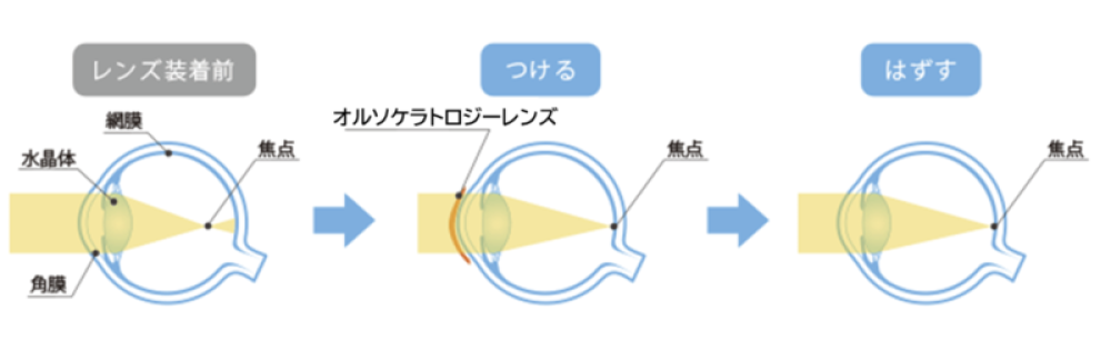 仕組み